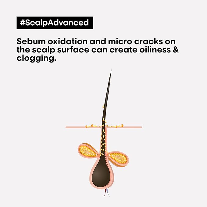 L'Oréal Professionnel Scalp Advanced Cleansing Shampoo – Oily Scalp Care 300ml