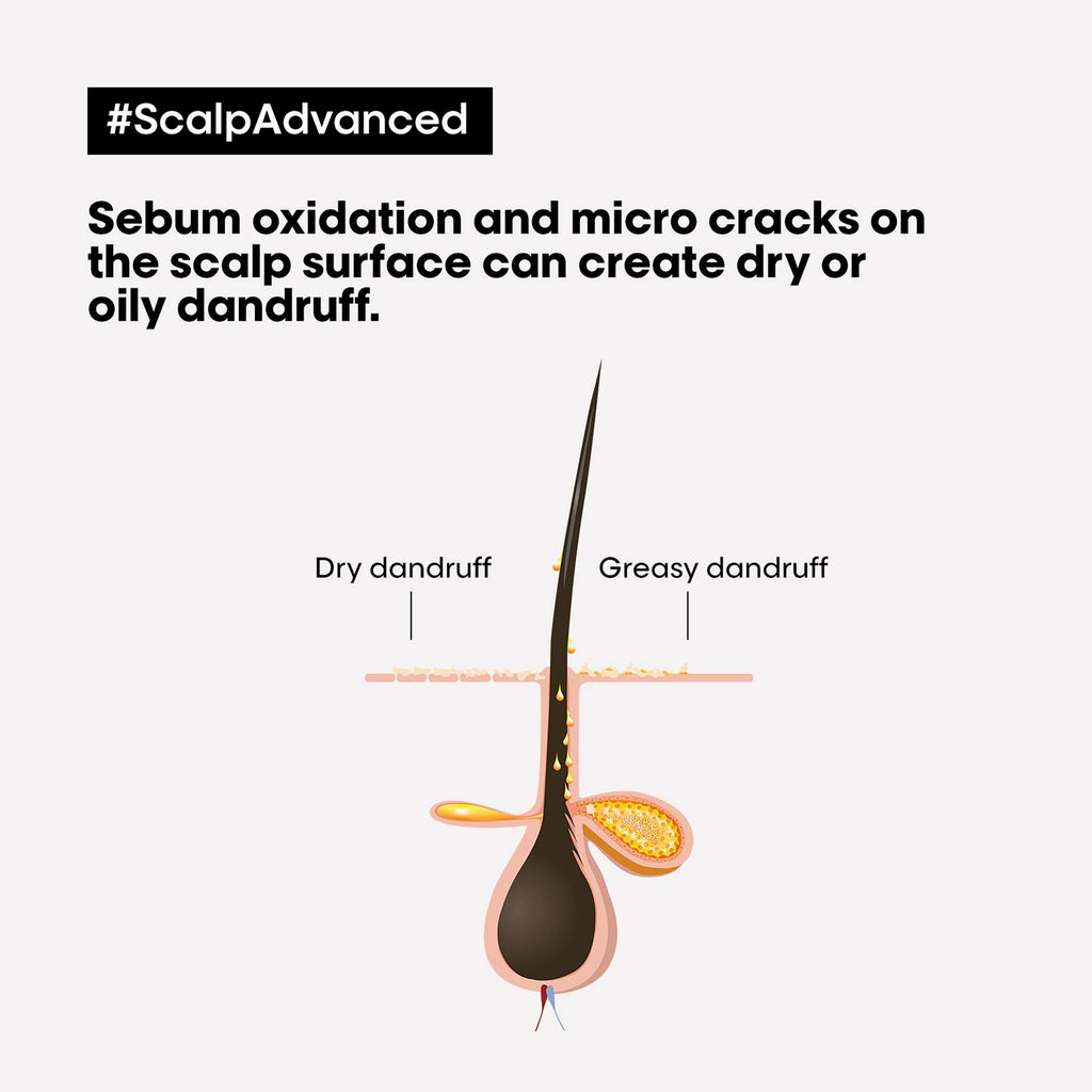 L'Oréal Professionnel Scalp Advanced Professional Clay 250ml