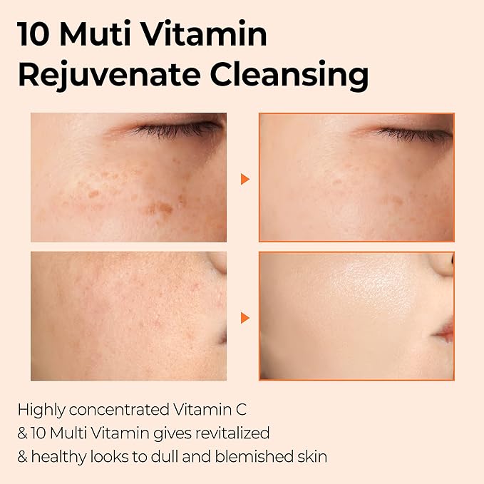 Some by mi bar soap 106g 10 v vita for skin cleansing