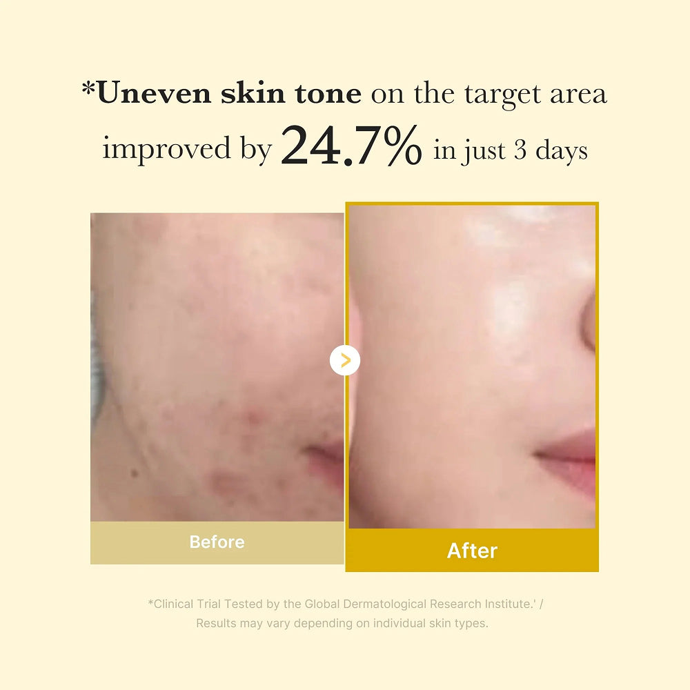 Medicube Kojic Acid Turmeric Night Wrapping Mask - 75ml
