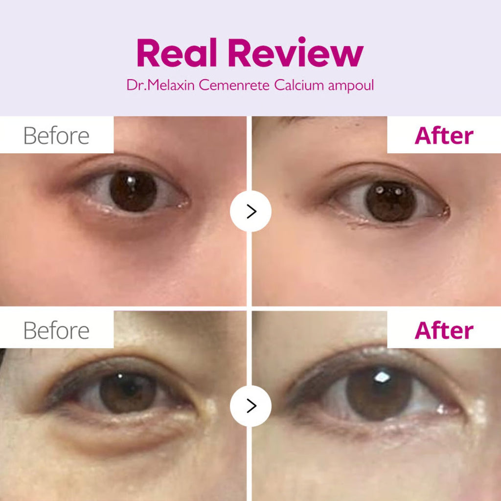 Dr. Melaxin Cemenrete CX Calcium Intense Ampoule Plus - 30ml