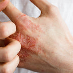 QV Flare Up Cream for Eczema and Dry Skin – Soothing Barrier Repair